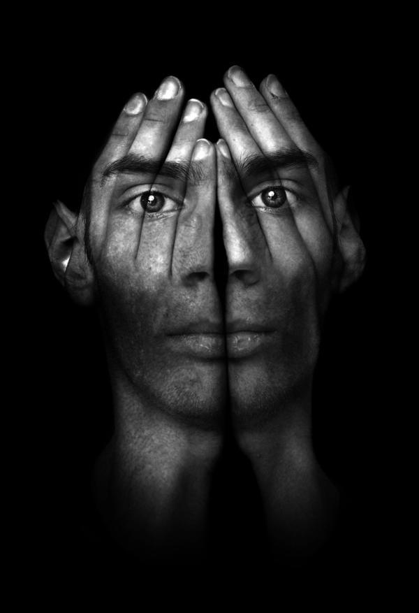 Understanding Schizophreniform Disorder